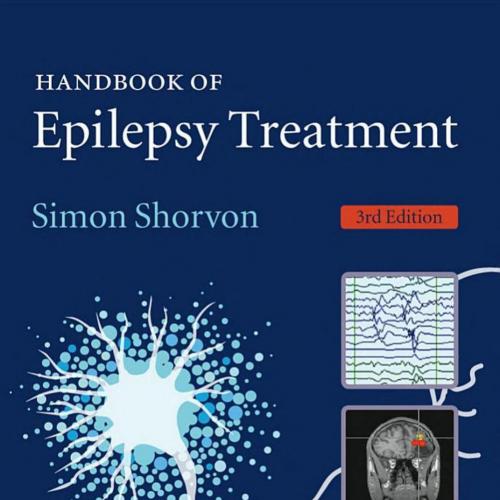 Handbook of Epilepsy Treatment 3rd Edition