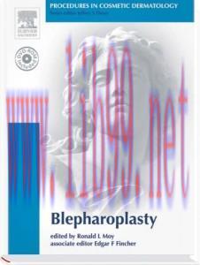[AME]Procedures in Cosmetic Dermatology Series: Blepharoplasty (Original PDF)
