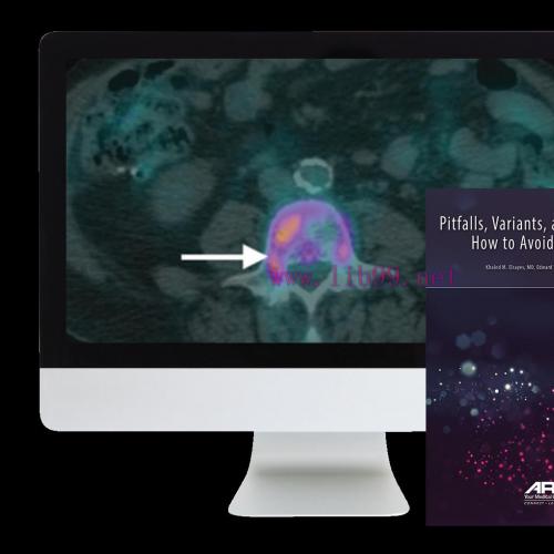 [AME]ARRS Pitfalls, Variants, and Pseudolesions: How to Avoid Misdiagnosis 2019 (CME VIDEOS)