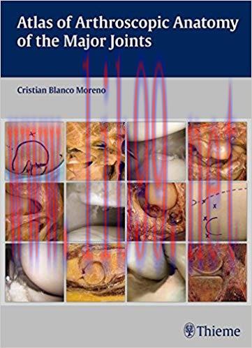 [PDF]Atlas of Arthroscopic Anatomy of the Major joints