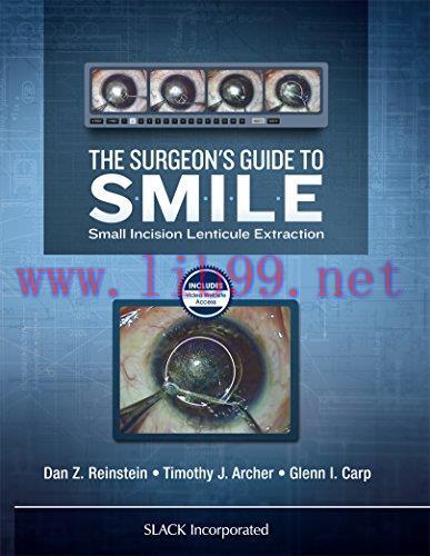 [AME]The Surgeon's Guide to SMILE: Small Incision Lenticule Extraction (PDF)