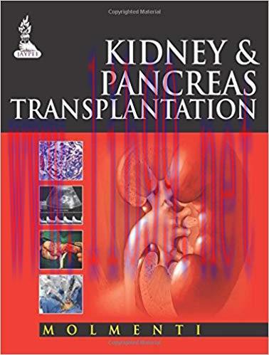 [PDF]Kindney and Pancreas Transplantation