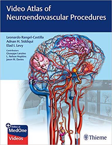 Video Atlas of Neuroendovascular Procedures, PDF+ (11.9GB) 138 VIDEOS