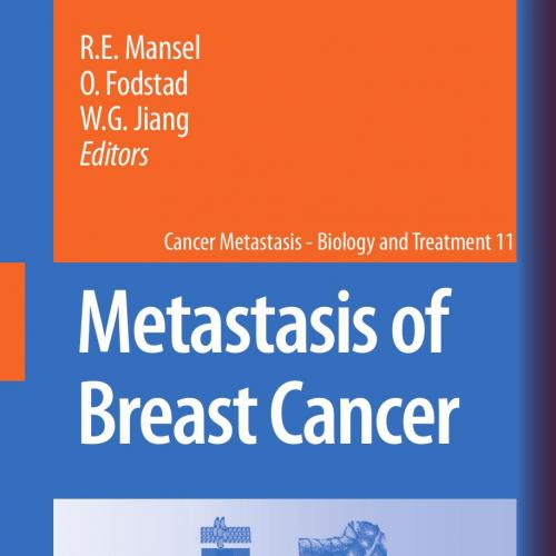 Metastasis of Breast Cancer - Wei Zhi