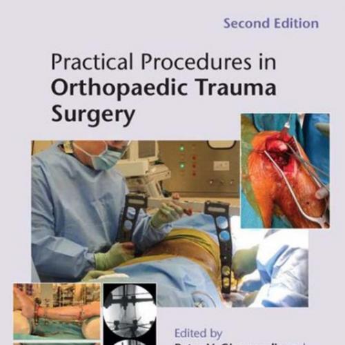 Practical Procedures In Orthopaedic Trauma Surgery, 2nd Edition