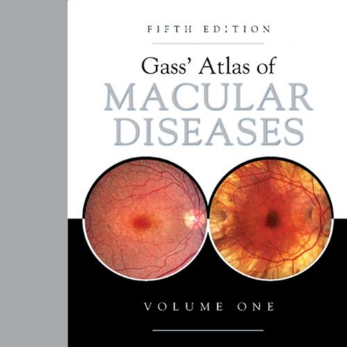 Gass’ Atlas of Macular Diseases, 5th Edition 2-Volume Set