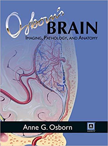 Osborn’s Brain - Imaging, Pathology, and Anatomy