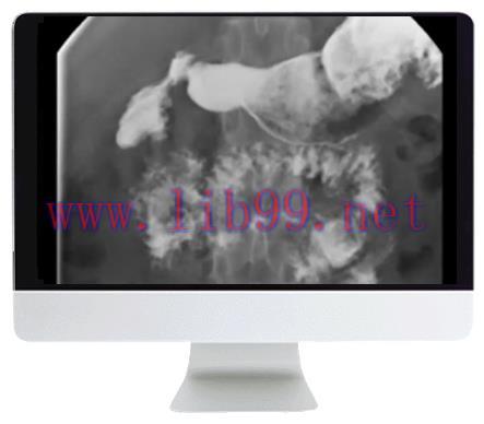 [AME]ARRS Practical Pediatric Imaging 2021 (CME VIDEOS)