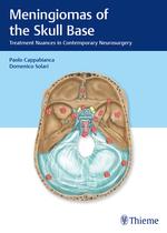 Meningiomas of the Skull Base Treatment Nuances in Contemporary Neurosurgery 1st Edition