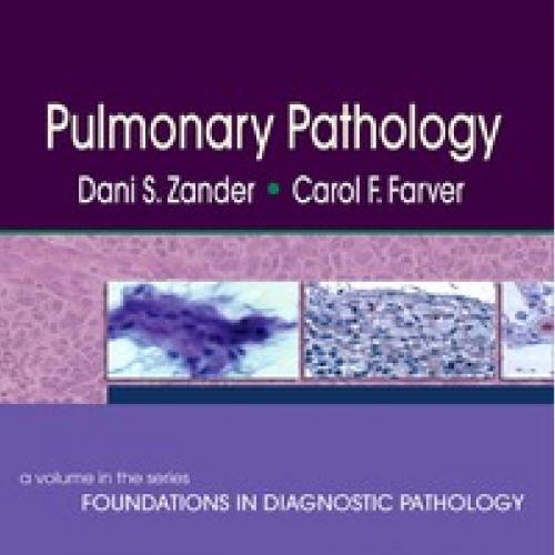 Pulmonary Pathology-A Volume in Foundations in Diagnostic Pathology - Wei Zhi