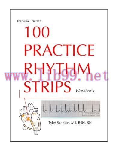 [AME]The Visual Nurse’s 100 Practice Rhythm Strips Workbook (The Visual Nurse’s Basic ECG Serie...