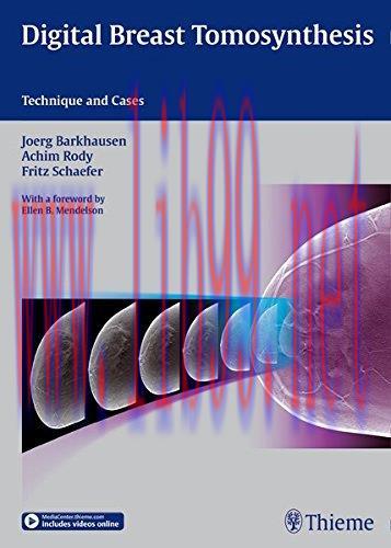 [AME]Digital Breast Tomosynthesis: Technique and Cases (ORIGINAL PDF from_ Publisher)