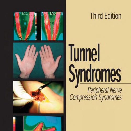 Tunnel Syndromes 3rd Edition