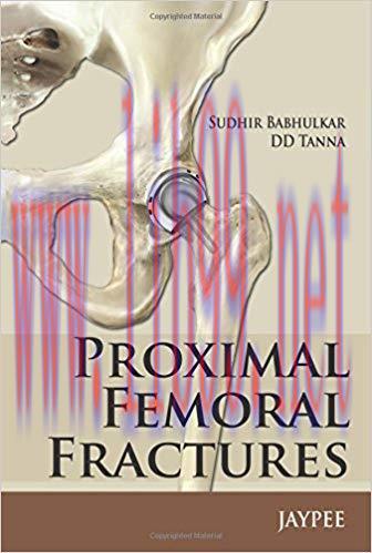 [PDF]Proximal Femoral Fractures