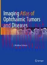 [PDF]Imaging Atlas of Ophthalmic Tumors and Diseases