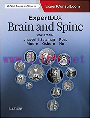 (PDF)ExpertDDx: Brain and Spine E-Book 2nd Edition