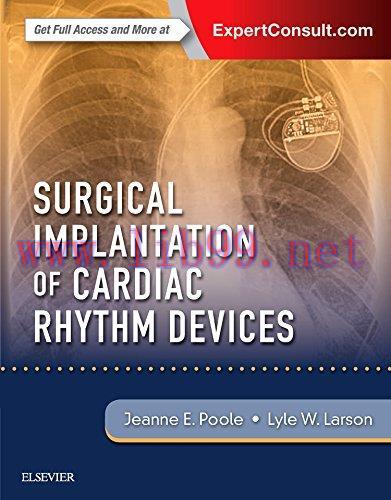 [AME]Surgical Implantation of Cardiac Rhythm Devices (Videos Only, Well Organized)