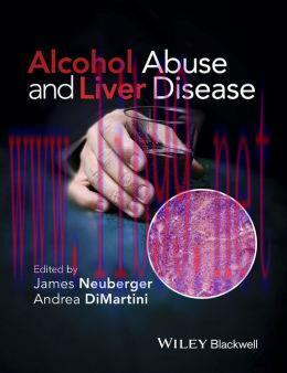 [AME]Alcohol Abuse and Liver Disease