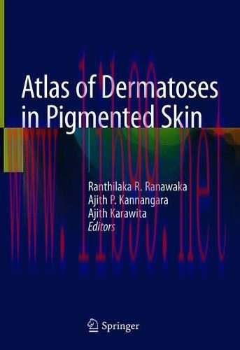 [AME]Atlas of Dermatoses in Pigmented Skin (Original PDF)