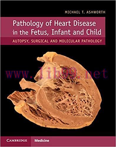 [PDF]Pathology of Heart Disease in the Fetus, Infant and Child