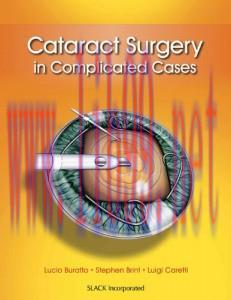 [AME]Cataract Surgery in Complicated Cases (ORIGINAL PDF from_ Publisher)