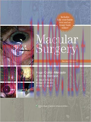 [PDF]Macular Surgery, 2nd Edition