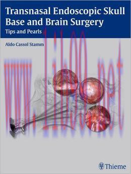 [AME]Transnasal Endoscopic Skull Base and Brain Surgery: Tips and Pearls (ORIGINAL PDF from_ Pu...