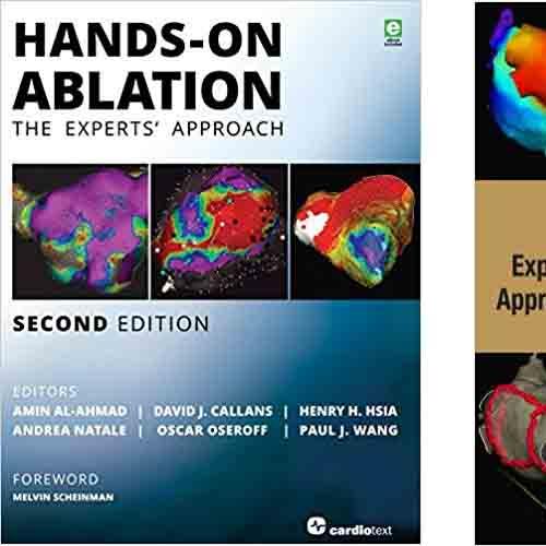 Hands-On Ablation The Experts’ Approach, 2nd Edition + 1e