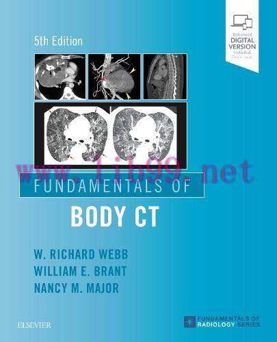 [AME]Fundamentals of Body CT (Fundamentals of Radiology), 5th Edition (True PDF)
