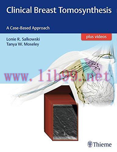 [AME]Clinical Breast Tomosynthesis: A Case-Based Approach (EPUB)