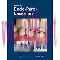 [AME]Endo-Paro-Läsionen (German Edition) (EPUB)