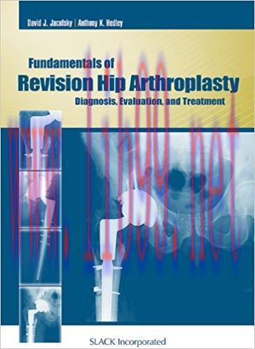 [PDF]Fundamentals of Revision Hip Arthroplasty - Diagnosis, Evaluation, and Treatment