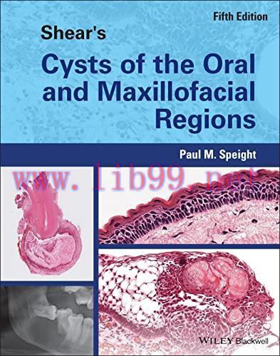 [AME]Shear's Cysts of the Oral and Maxillofacial Regions, 5th Edition (Original PDF)