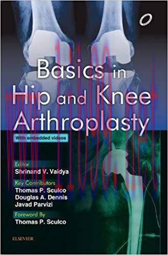 [PDF]Basics in Hip and Knee Arthroplasty