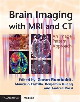 [AME]Brain Imaging with MRI and CT: An Image Pattern Approach