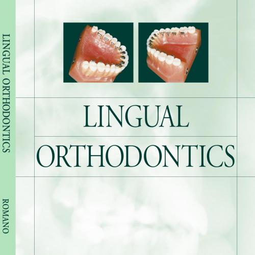 Lingual Orthodontics