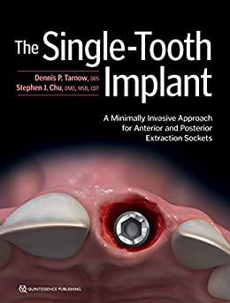The Single-Tooth Implant A Minimally Invasive Approach for Anterior and Posterior Extraction So...