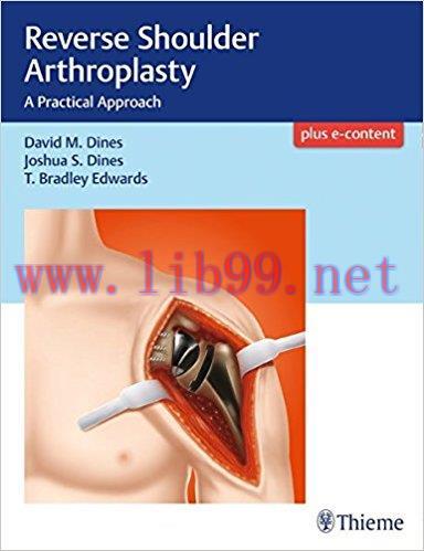 [AME]Reverse Shoulder Arthroplasty: A Practical Approach (EPUB)