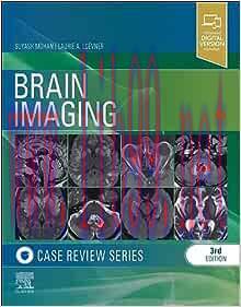 [AME]Brain Imaging: Case Review Series, 3rd edition (ePub+Converted PDF)