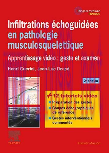 [AME]Infiltrations échoguidées en pathologie musculosquelettique: Apprentissage vidéo : geste e...