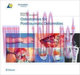 [AME]Osteotomies for Posttraumatic Deformities (ORIGINAL PDF from_ Publisher)
