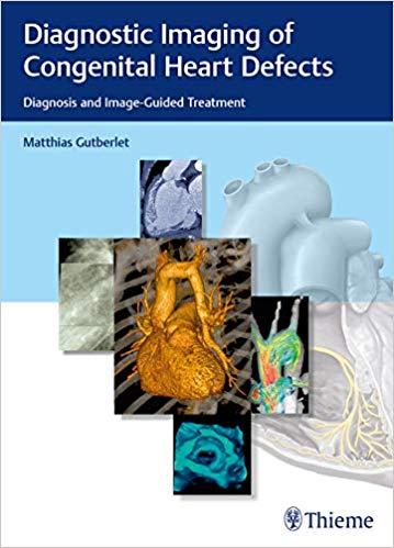 Diagnostic Imaging of Congenital Heart Defects