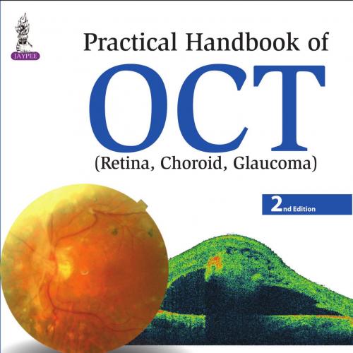 Practical Handbook of OCT 2nd Edition