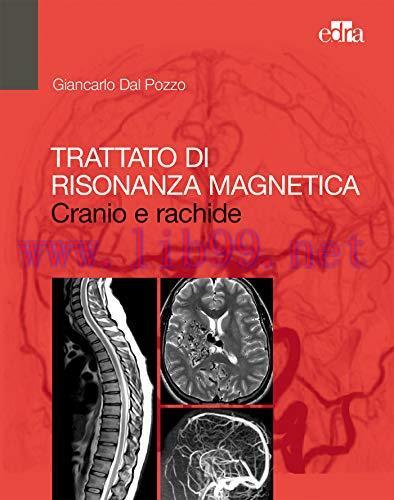 [AME]Trattato di Risonanza Magnetica: Cranio e rachide (Italian Edition) (EPUB)