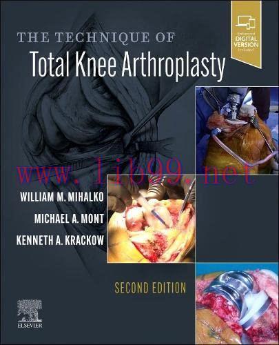 [AME]The Technique of Total Knee Arthroplasty, 2nd edition (Original PDF)