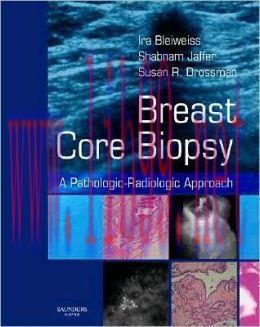 [AME]Breast Core Biopsy: A Pathologic-Radiologic Approach (Original PDF)
