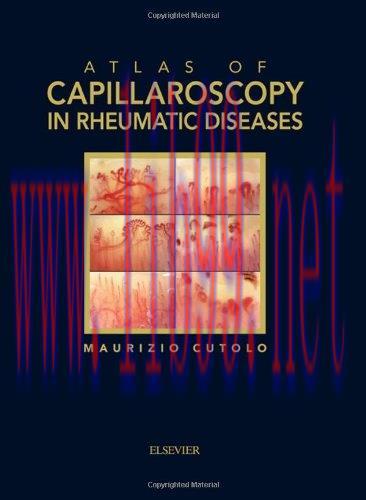 [AME]Atlas of Capillaroscopy in Rheumatic Diseases (Original PDF)
