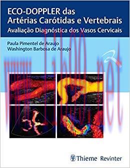 [AME]ECO-DOPPLER das Artérias Carótidas e Vertebrais: Avaliação Diagnóstica dos Vasos Cervicais...