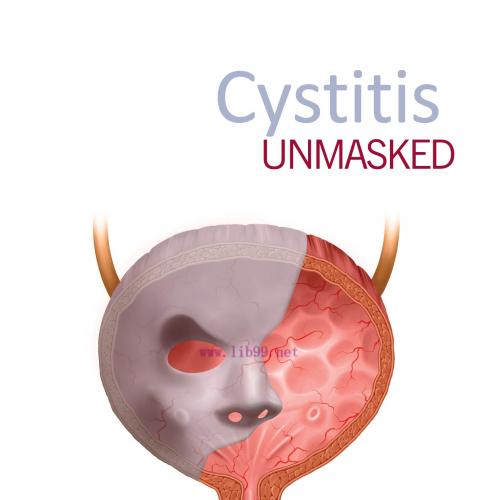 [AME]Cystitis unmasked (EPUB)