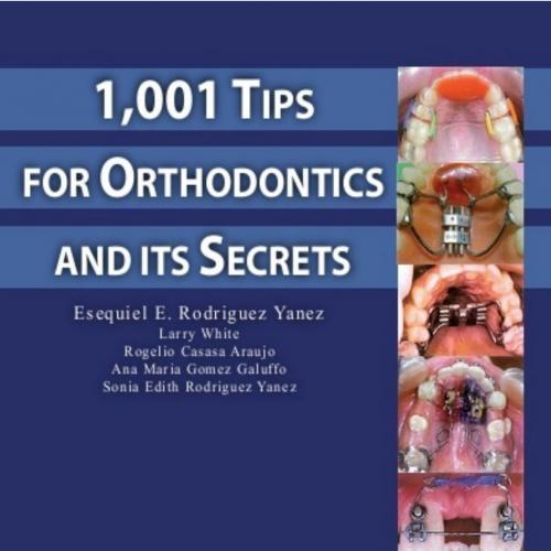 1,001 Tips for Orthodontics and its Secrets